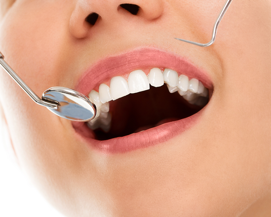 Everything You Need To Know About Composite Fillings