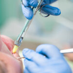 how sedation dentistry improves dental experience