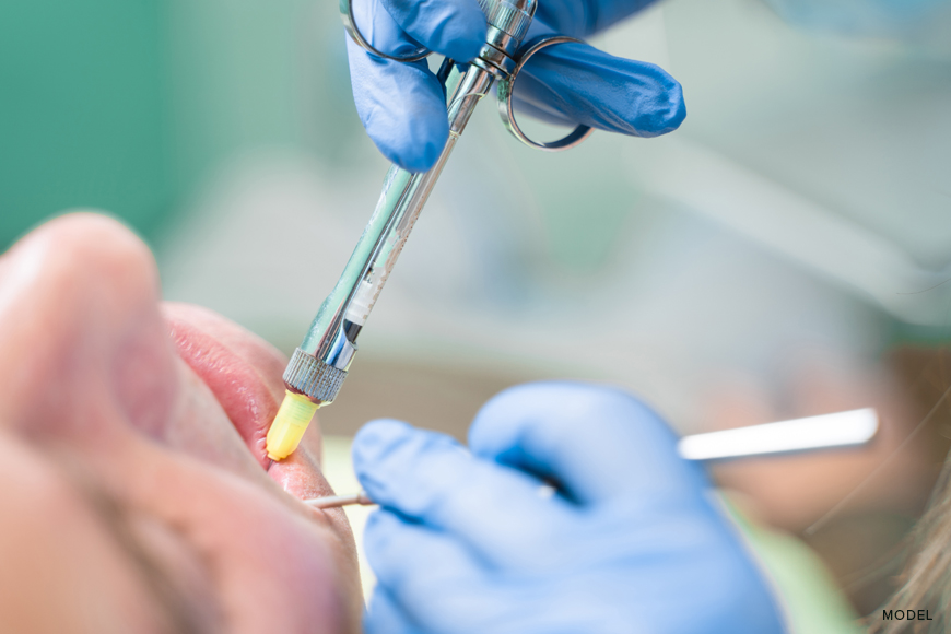 how sedation dentistry improves dental experience