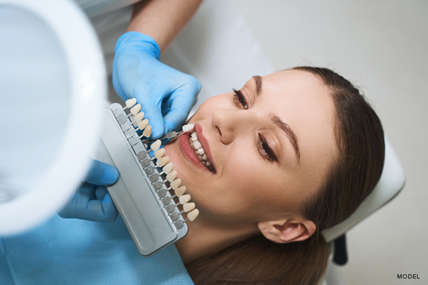 what you should know before getting veneers