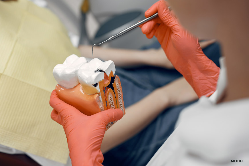 signs you need root canal therapy