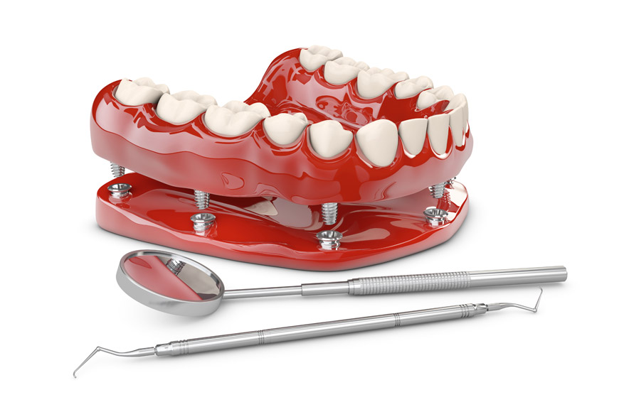 Ditch Those Dentures and Go For Full-Arch Dental Implants