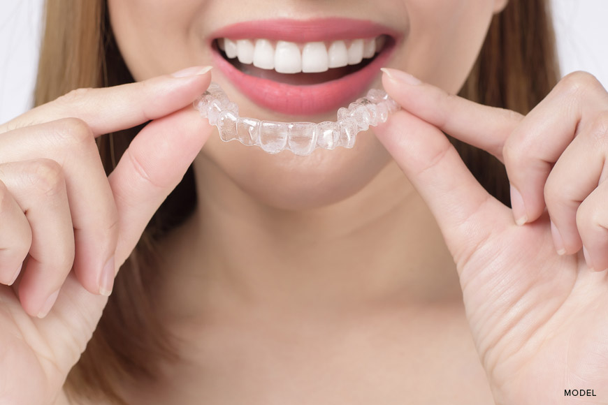 Invisalign For Teens