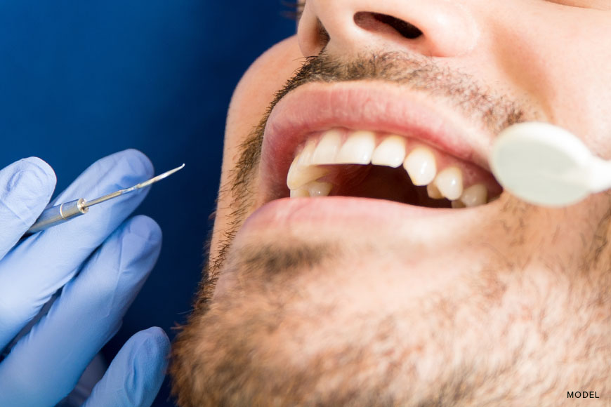 Revive Your Smile With Bone Grafting