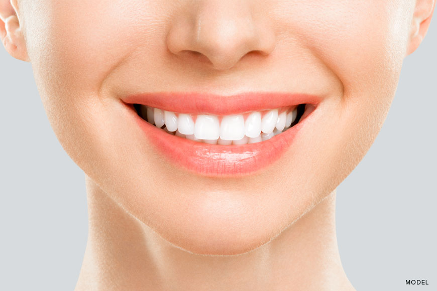 All-On-4 Dental Implants Step By Step Guide