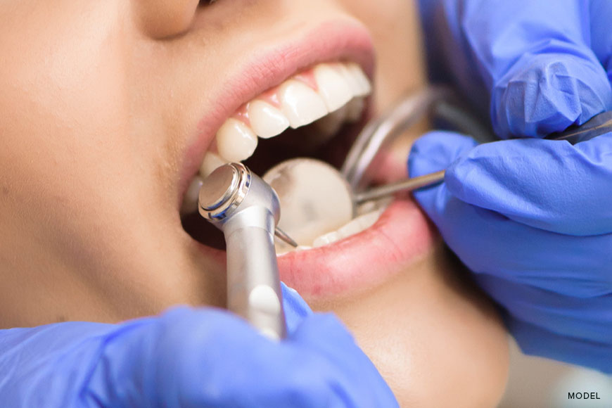 Dental Implant Process: A Step-by-Step Guide for Patients