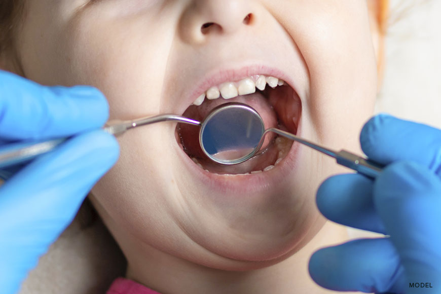 Different Types of Dental Sedation for Kids
