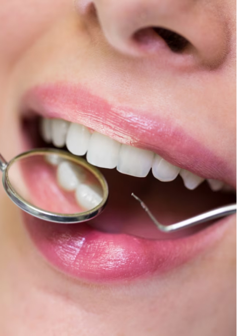 Color-matched composite fillings without mercury contents.