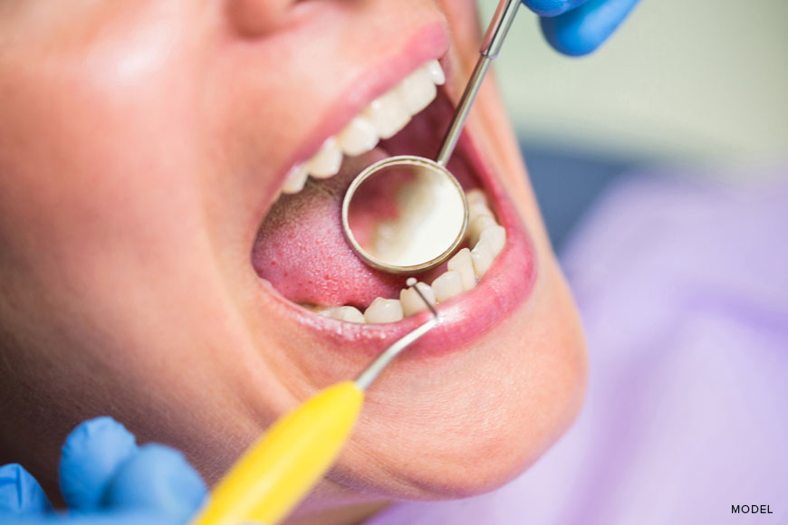 Preventative Dentistry vs. Restorative Dentistry: Which is Right for You?