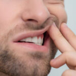 Itchy Gums: Identifying and Addressing the Discomfort
