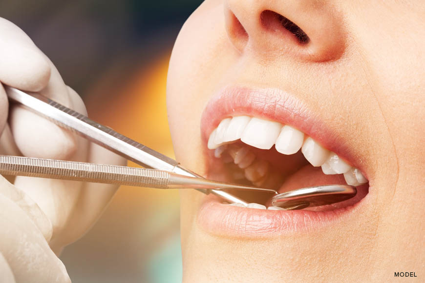 https://madisondentistryllc.com/wp-content/uploads/2023/11/how-to-prepare-for-wisdom-teeth-removal.jpg