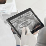 Types of Dental X-Rays: Understanding its Importance