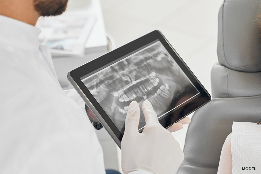 Types of Dental X-Rays: Understanding its Importance