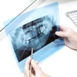 Roles of Panoramic X-Rays in Oral Care