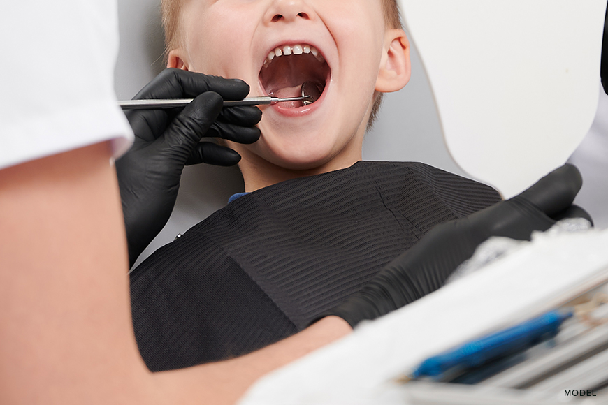 Understanding Pediatric Root Canal: Facts Every Parent Should Know