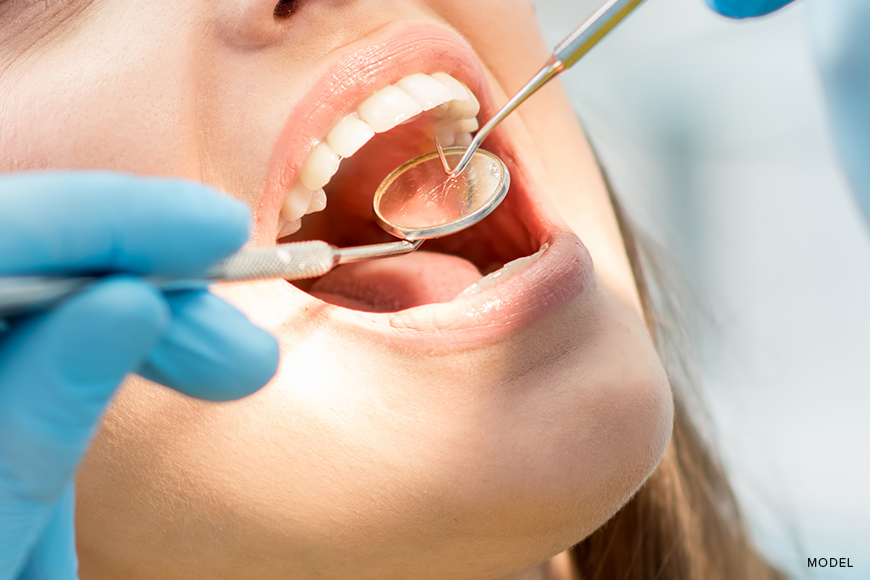 Root Canal Vs. Tooth Extraction: Understanding Your Options