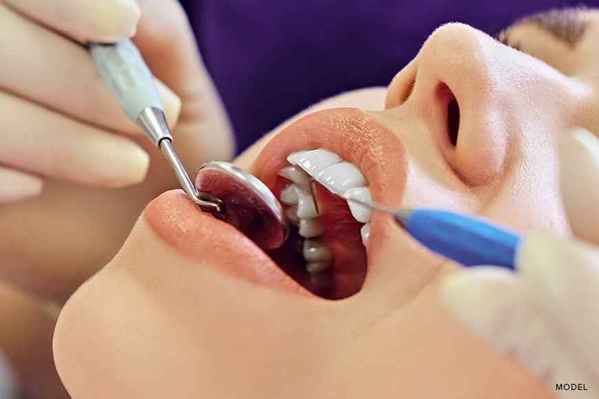 Composite Dental Fillings vs Amalgam: Understanding Your Choices