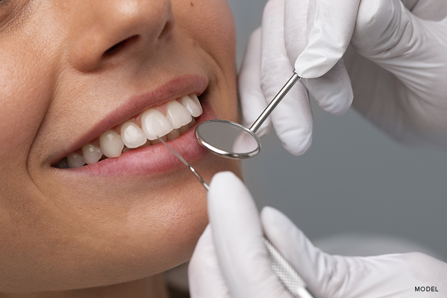 Dental Crowns vs Fillings: Making Informed Choices for Your Dental Health