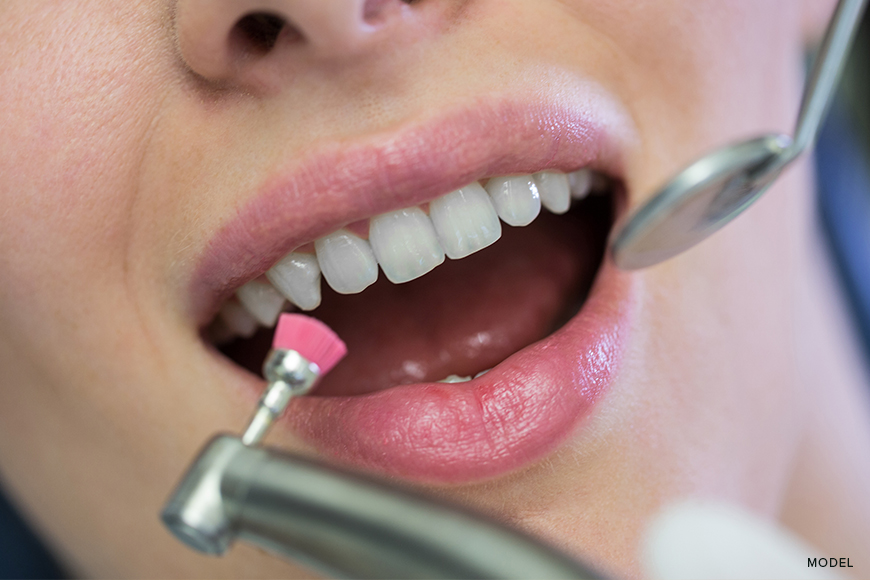 Dental Sealants vs. Dental Fillings: Grasping the Contrast