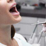 Dental Implants Recovery: What to Expect After Surgery