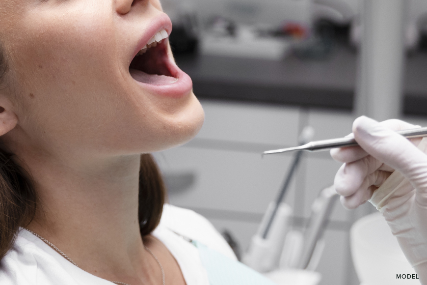 Dental Implants Recovery: What to Expect After Surgery