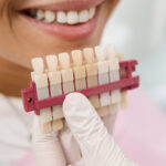 Exploring Dental Veneers Types