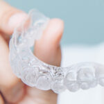 Mouthguards for TMJ: A Solution for Jaw Pain