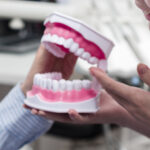 Veneers VS Dental Implants