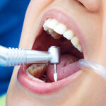 Dental Implant Maintenance: Keeping Your Smile Healthy