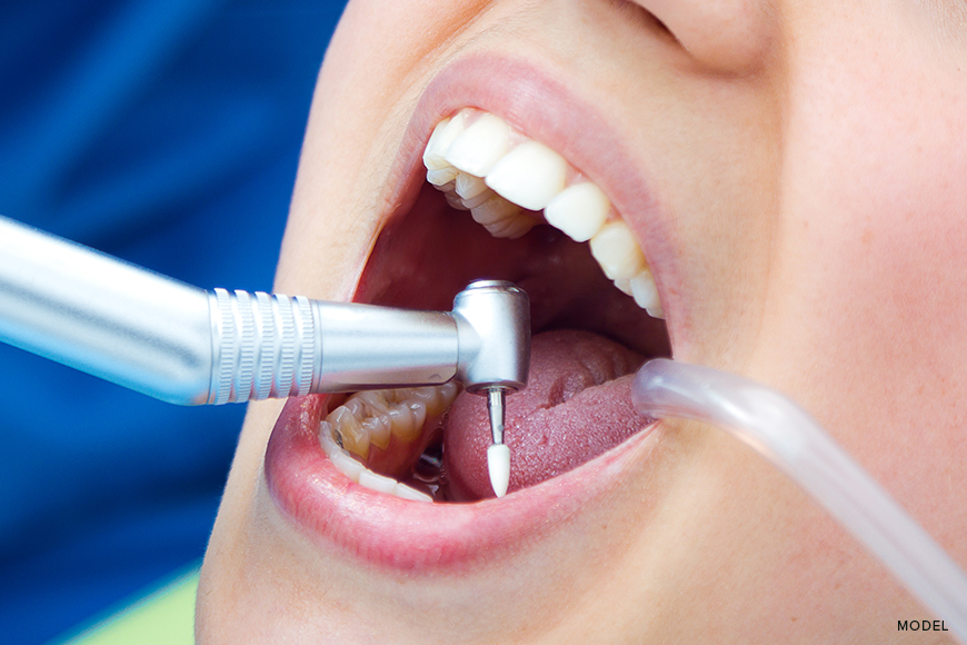 Dental Implant Maintenance: Keeping Your Smile Healthy