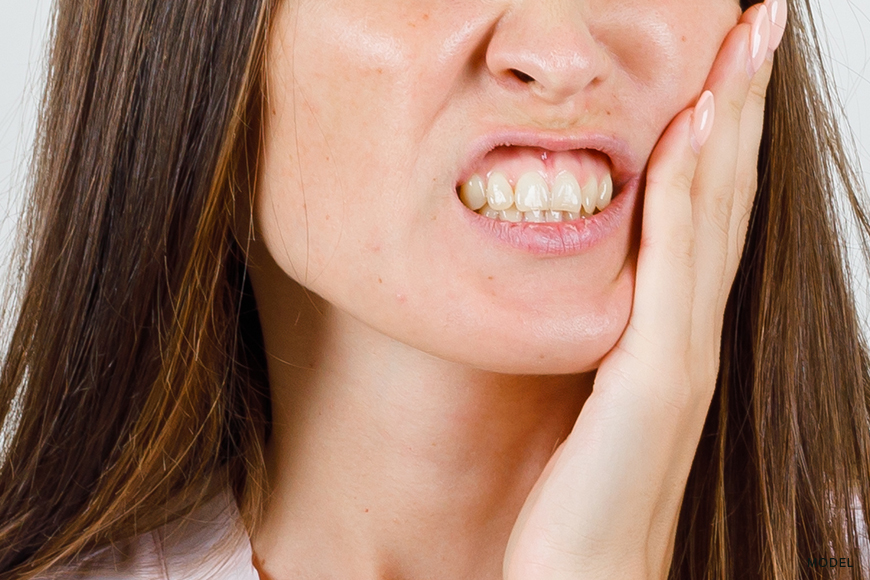 When Does Swelling From Wisdom Teeth Stop?