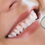 The Role of Abutment Teeth in Dental Treatments