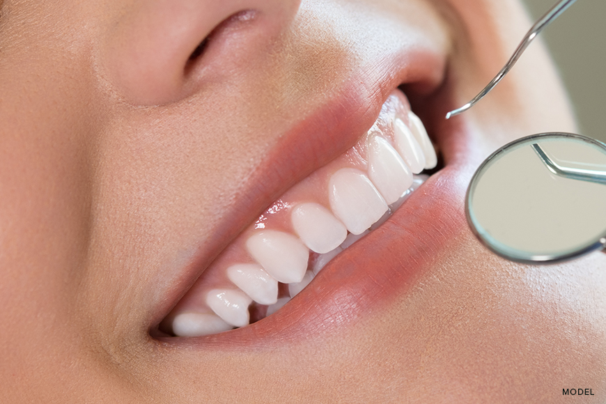 The Role of Abutment Teeth in Dental Treatments