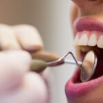 Smile Transformation: Discovering the Benefits of Dental Crowns in NJ