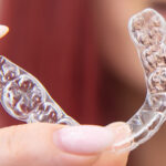 Invisalign for Crowded Teeth