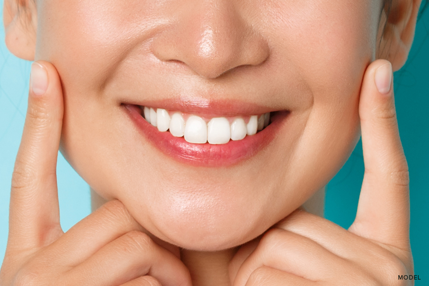 Veneers for Missing Teeth: A Complete Set Solutions