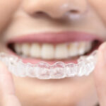 Invisalign Benefits