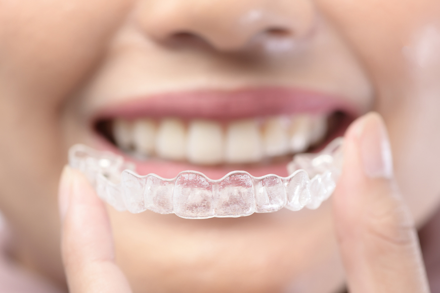 Invisalign Benefits