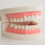 How To Clean Dentures