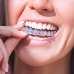 Invisalign Crowded Teeth