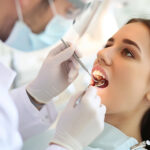 How Long Do Dental Fillings Last