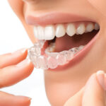 Does Invisalign Work
