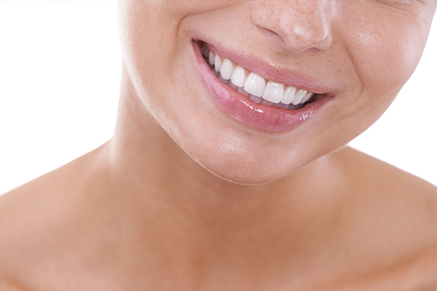 Benefits of Dental Cleaning