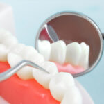 Dental Filling Benefits