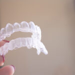 Invisalign Timeline