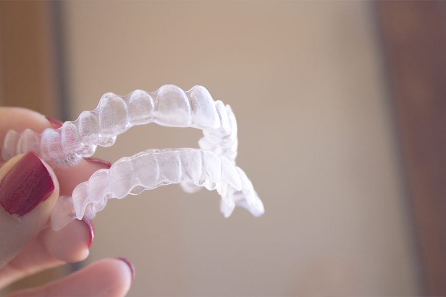 Invisalign Timeline