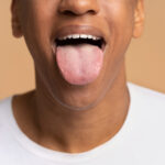 Oral Thrush Treatment in New Jersey - Madison Dentistry & Implant Center - Madison, New Jersey