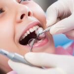 Are you awake during wisdom teeth removal - Madison Dentistry & Implant Center - Madison, New Jersey