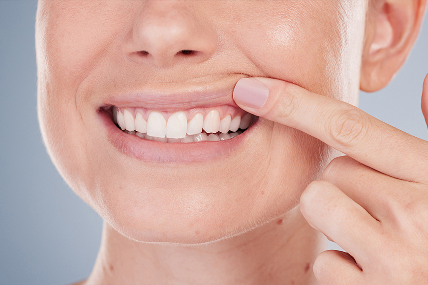 What Causes Soft Teeth - Madison Dentistry & Implant Center - Madison, New Jersey