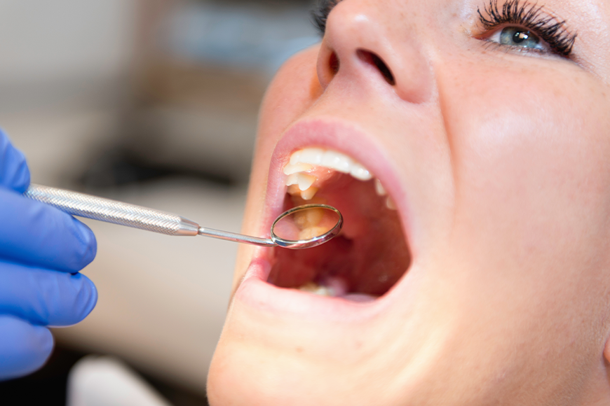Emergency Tooth Extraction - Madison Dentistry & Implant Center - Madison, New Jersey